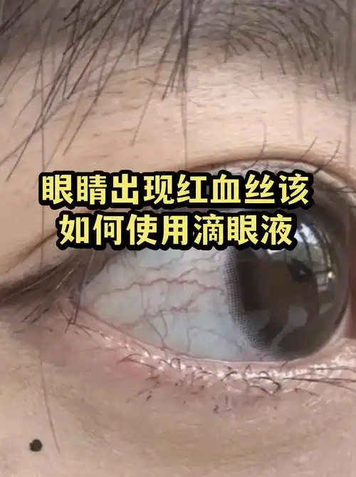LPL夏季赛惊现“全图透视”装备？新版视野神器彻底颠覆赛场格局